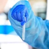 Hantavirus, il punto: contagio e sintomi, cosa c'è da sapere e come proteggersi