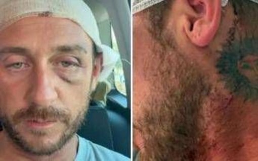 "Io aggredito a sassate in Sardegna da 30 persone perché gay", la denuncia sui social ﻿
