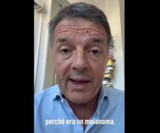 Renzi e il melanoma: "L'ho rimosso, nessun rischio per me ma bisogna controllarsi" Renzi e il melanoma: "L'ho rimosso, nessun rischio per me ma bisogna controllarsi"