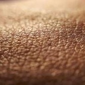 Dermatite atopica, quando la pelle condiziona la vita, 'Diari atipici' dà voce ai pazienti