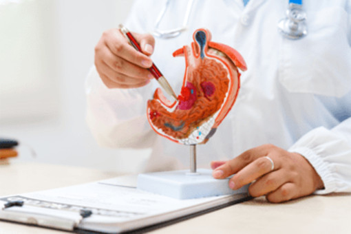 Tumore allo stomaco, pazienti: &quot;Diagnosi precoce per meno di 1 su 5, migliorare percorsi&quot;