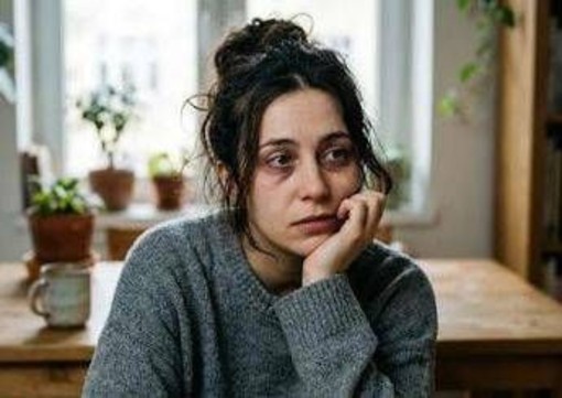 Ferritin face, boom di foto sui social. Ma la carenza di ferro si legge davvero sul viso?